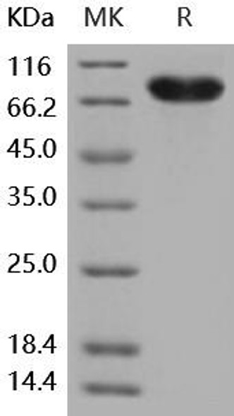Human CD14 Recombinant Protein (RPES0451)