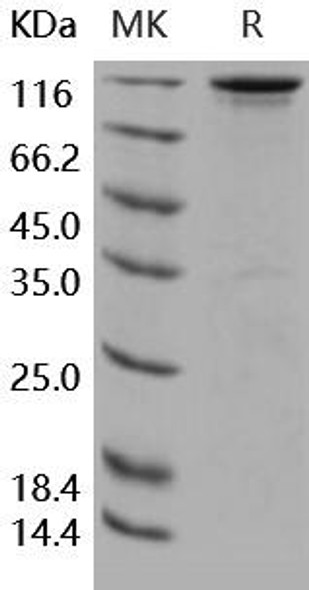 Human HER3/ErbB3 Recombinant Protein (RPES0465)