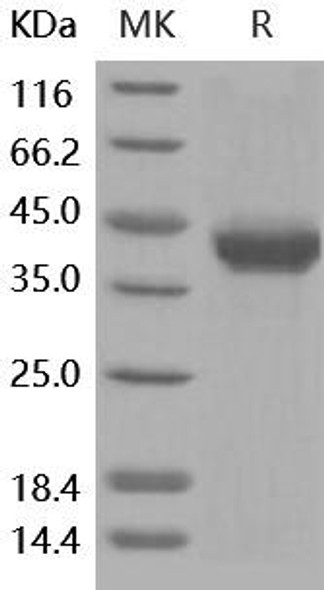 Human AgRP/AGRP Recombinant Protein (RPES0469)