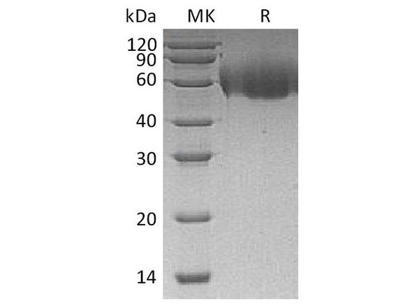 Human CD155/PVR/NECL5 Recombinant Protein (RPES0478)