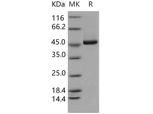 Human KYNU/Kynureninase Recombinant Protein (RPES0483)