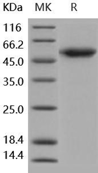 Human ALK/ACVRL1 Recombinant Protein (RPES0489)