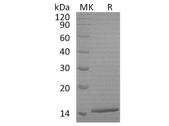 Human HBA1 Recombinant Protein (RPES0491)