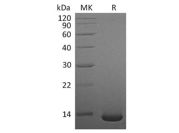 Human/Mouse/Rat BMP-2 Recombinant Protein (RPES0494)