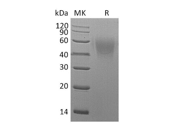 Mouse CD86/B7-2 Recombinant Protein (RPES0518)