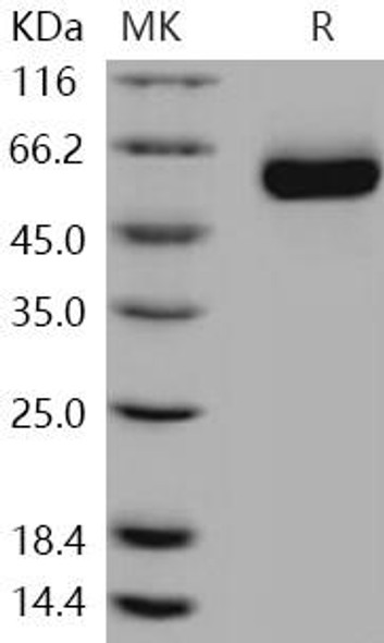 Human DLL1/Delta Recombinant Protein (RPES0521)