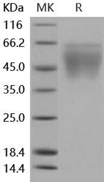 Mouse CD86/B7-2 Recombinant Protein (RPES0526)