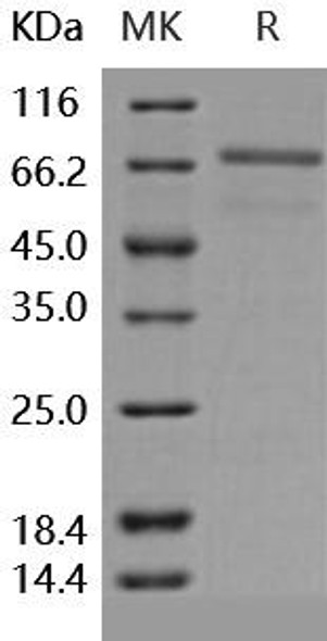 Human EphB6 Recombinant Protein  (RPES0542)