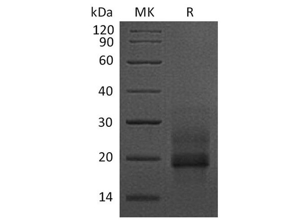 Human HBEGF Recombinant Protein (RPES0548)