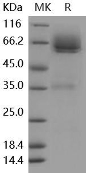 Mouse LYVE1/HAR Recombinant Protein (RPES0564)