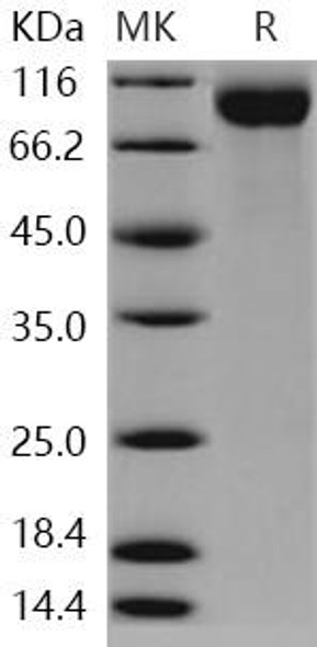 Human SIGLEC2/CD22 Recombinant Protein (RPES0565)