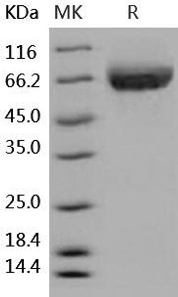 Human ALCAM/CD166 Recombinant Protein (RPES0584)