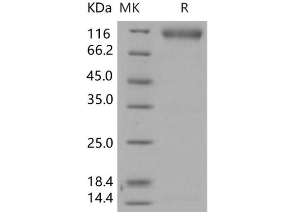 Human FGFR2/CD332 Recombinant Protein (RPES0638)