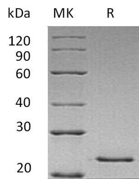 Human HGF Recombinant Protein (RPES0645)