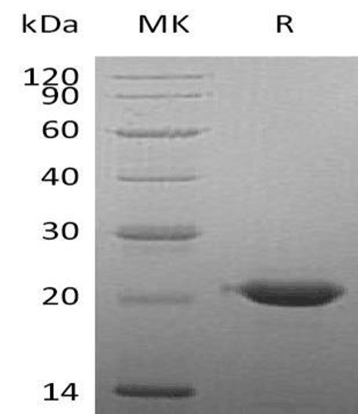 Human CLEC3B/Tetranectin Recombinant Protein (RPES0663)