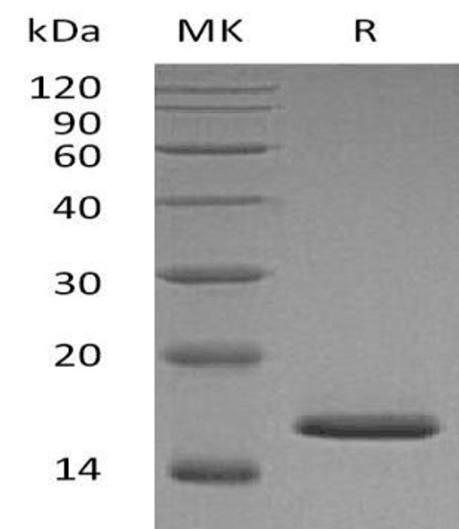 Mouse FGF/FGFa Recombinant Protein (RPES0686)