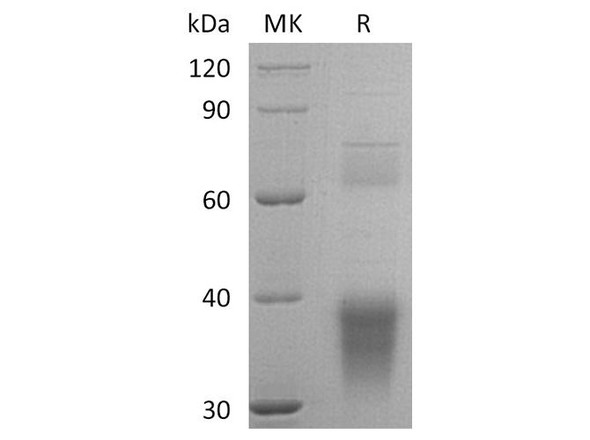 Human Clusterin/ApoJ Recombinant Protein (RPES0699)