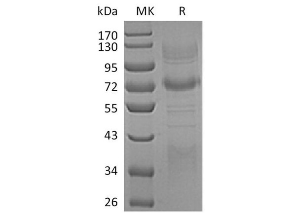 Human Clusterin/ApoJ Recombinant Protein (RPES0716)