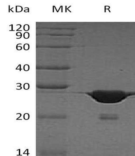 Human HMGB1 Recombinant Protein (RPES0717)