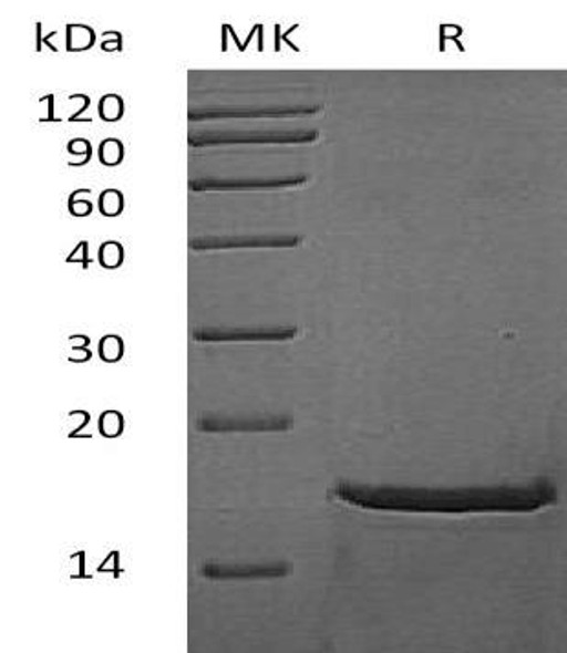 Mouse FGF-2/FGFb Recombinant Protein (RPES0721)