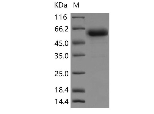 Rat TNFR1/TNFRSF1A Recombinant Protein (RPES0729)