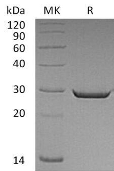 Human HMGB2 Recombinant Protein (RPES0752)