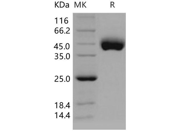 Human CD21/CR2/C3DR Recombinant Protein (RPES0763)