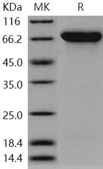 Human SEMA4A/Semaphorin B Recombinant Protein (RPES0767)