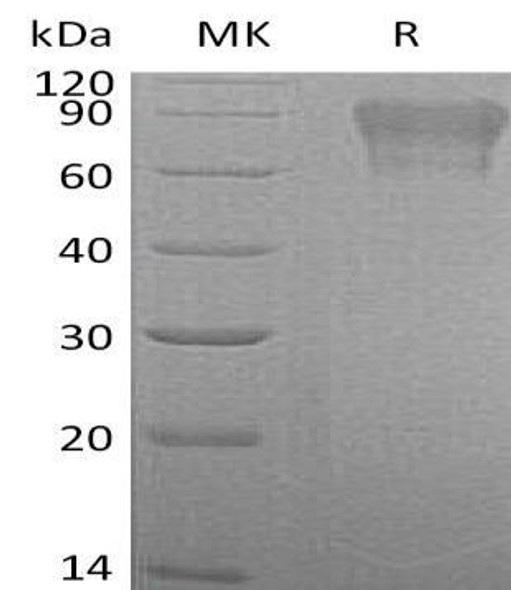 Coagulation Factor IX/F9 Recombinant Protein (RPES0769)