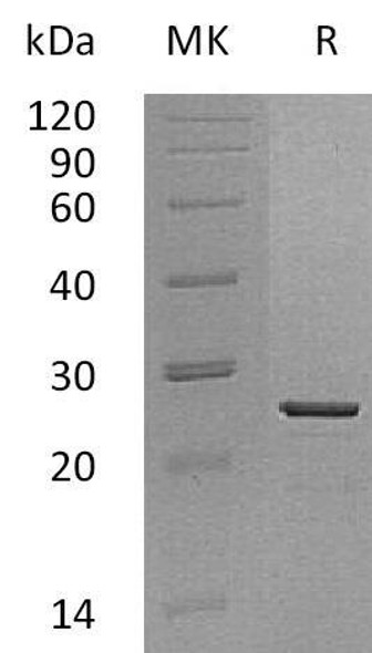 Human HMGB3 Recombinant Protein (RPES0770)