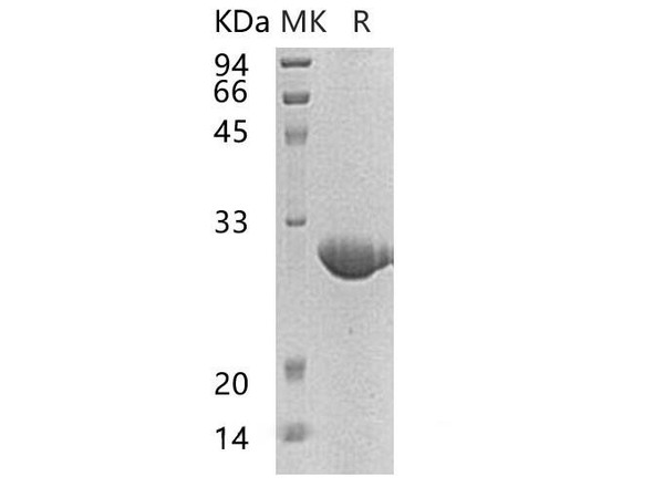 Human NOL3 Recombinant Protein (RPES0771)