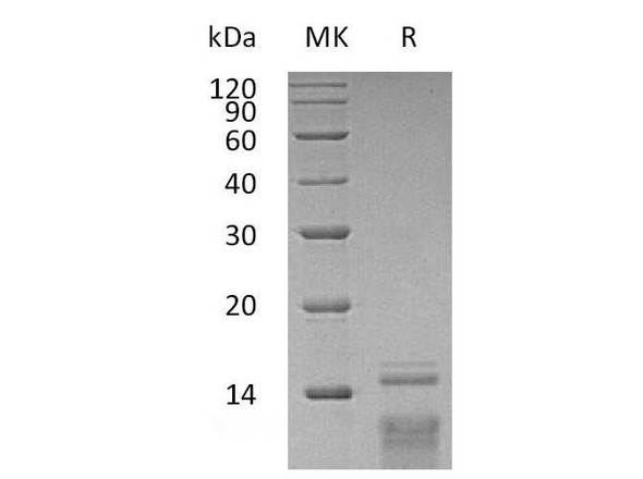 Human TSLP Recombinant Protein (RPES0772)