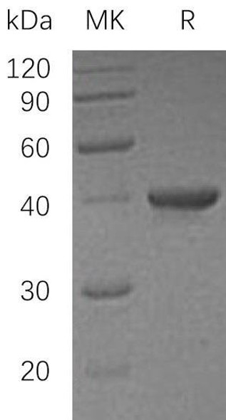 Human UBE2I/UBC9 Recombinant Protein (RPES0779)