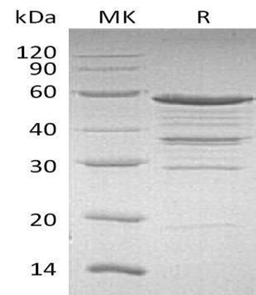 Human NOL3 Recombinant Protein (RPES0788)