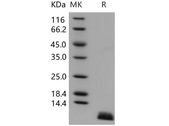 Human Uteroglobin/SCGB1A1 Recombinant Protein (RPES0799)