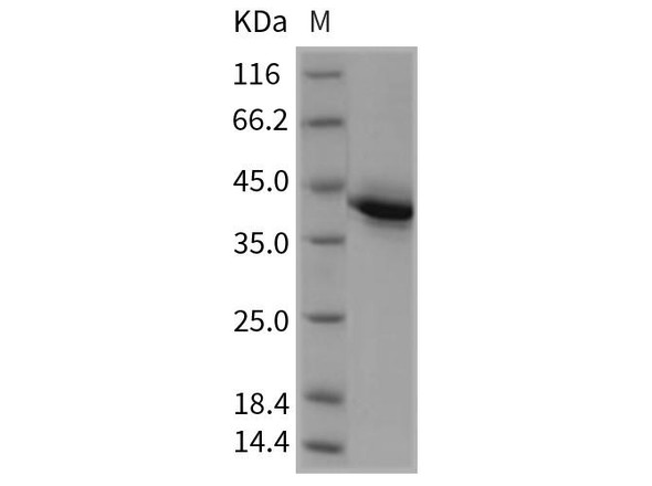 Rat TNFRSF17/BCMA Recombinant Protein (RPES0801)