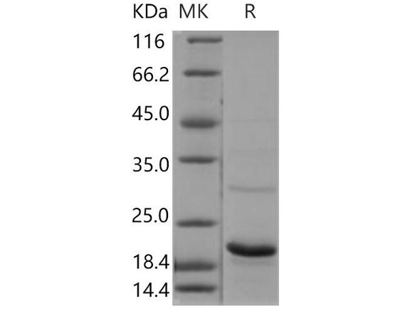 Human UBE2G1 Recombinant Protein (RPES0816)