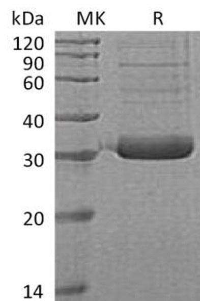 Human Collectin1/COLEC11 Recombinant Protein (RPES0824)