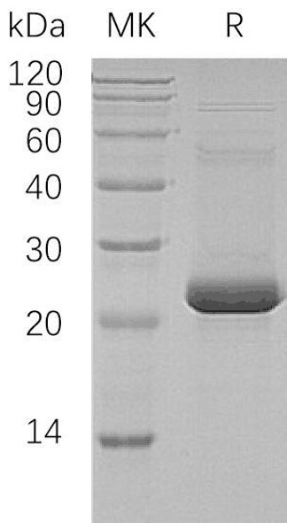 Human ASF1A Recombinant Protein (RPES0825)