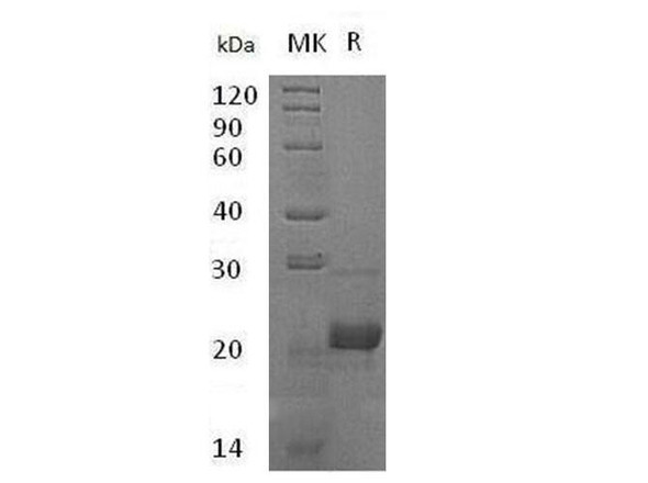 Human C8G Recombinant Protein (RPES0879)