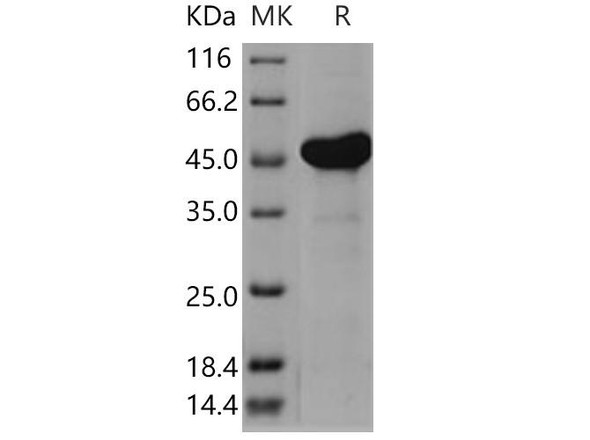 Human AK4/AK3L1 Recombinant Protein (RPES0889)
