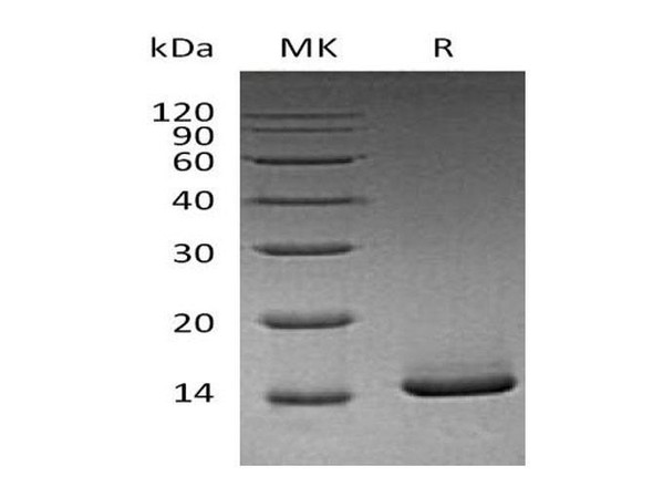 Mouse GM-CSF/CSF2 Recombinant Protein  (RPES0902)