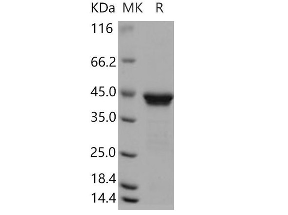 Human RRM2B/P53R2 Recombinant Protein (RPES0908)