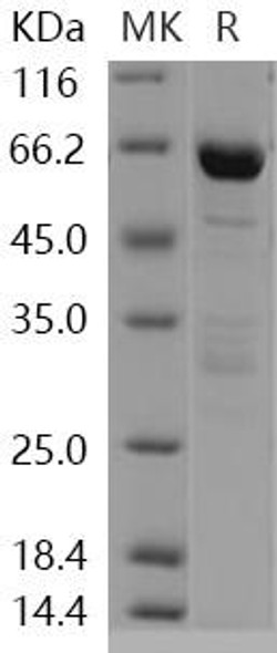 Human DCAMKL1 Recombinant Protein (RPES0909)