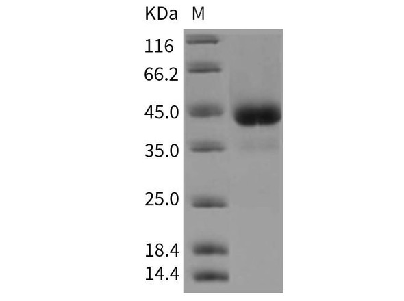 Rat ALK-2/ACVR1 Recombinant Protein (RPES0912)