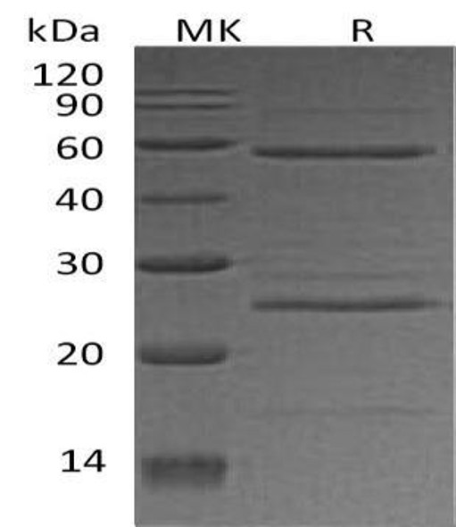 Human ODC1 Recombinant Protein (RPES0917)