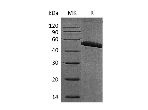 Mouse CD36/SCARB3 Recombinant Protein (RPES0924)