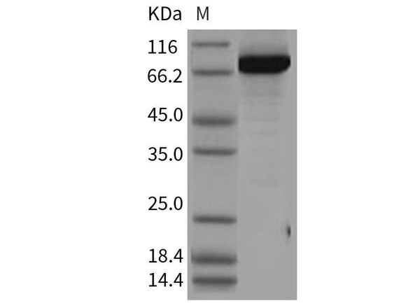 Human PBEF/NAMPT Recombinant Protein (RPES0932)