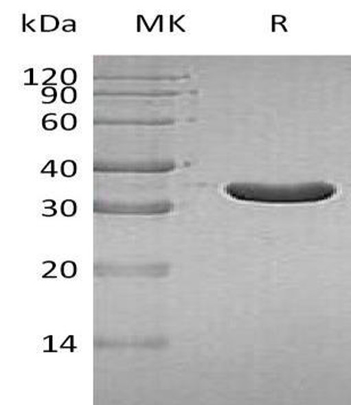 Human IA2/PTPRN Recombinant Protein (RPES0934)