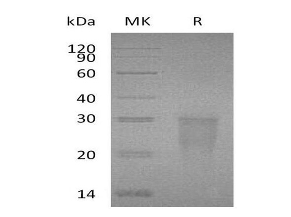 Human TMIGD2/IGPR Recombinant Protein (RPES0936)